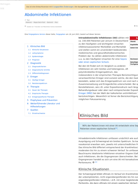 File:20260601174717!Revision 11352.png