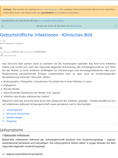 File:20260601174655!Revision 21334.png